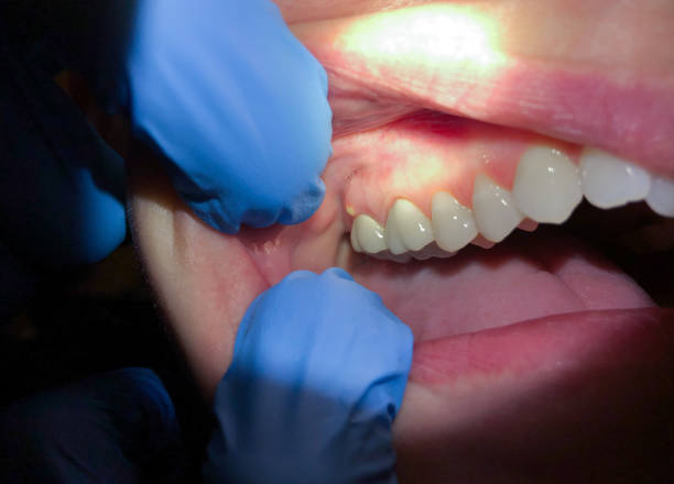 Best Urgent Tooth Repair  in Georgetown, KY