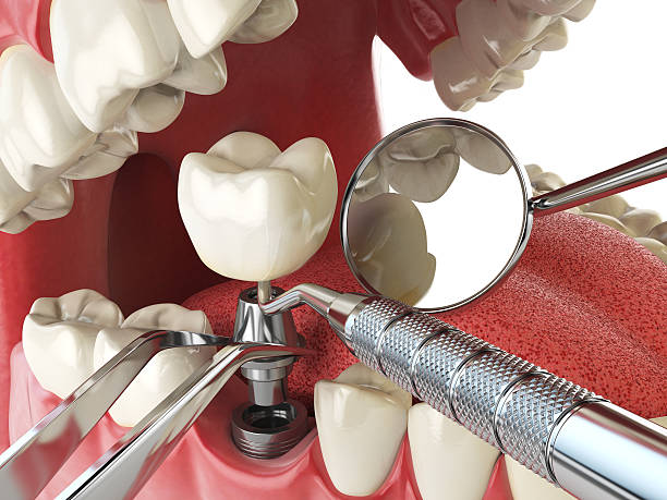Best Tooth Pain Emergency Relief  in Georgetown, KY